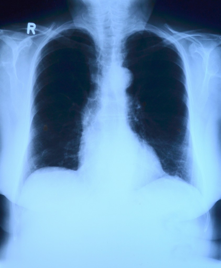x-ray-image-568241_1920